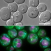 酵母の顕微鏡解析例。上は明視野像、下は蛍光像（緑：小胞体、水色：ミトコンドリア、赤紫：液胞）