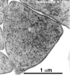 三角菌 [（ハロアーキュラ・ジャポニカ Haloarcula japonica）]の電子顕微鏡写真［Nishiyama et al., 1995］