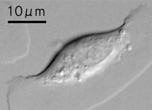 研究対象のひとつであるケラトサイトという細胞の顕微鏡写真